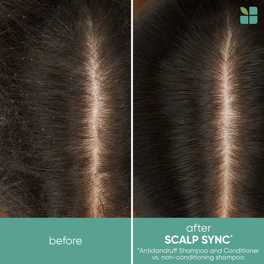 Scalp Sync Anti-Dandruff Shampoo