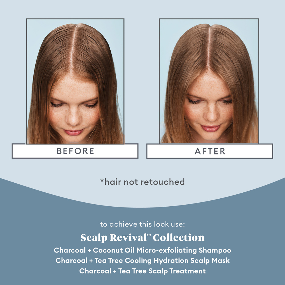 Scalp Revival™ Charcoal + Tea Tree Cooling Hydration Scalp Mask, 177ml