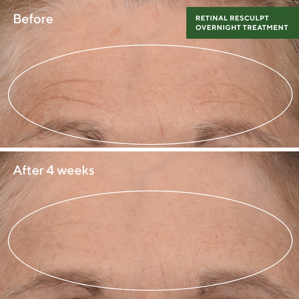 Retinal ReSculpt Treatment, 30ml